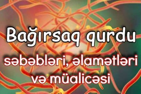 Bağırsaq qurdu: səbəbləri, əlamətləri və müalicəsi