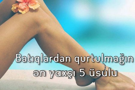 Batıqlardan qurtulmağın ən yaxşı 5 üsulu