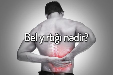 Bel yırtığı (qrija) nədir? Əlamətləri hansılardır?