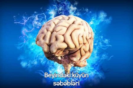 Beyindəki küyü necə azaltmaq olar?
