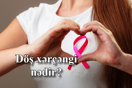 Döş xərçəngi nədir? Simptomlar və müalicə üsulları