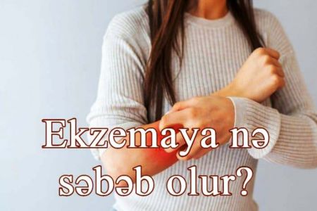 Ekzema nədir? Necə müalicə olunur?