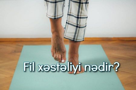 Fil xəstəliyi nədir? Simptomları və müalicəsi