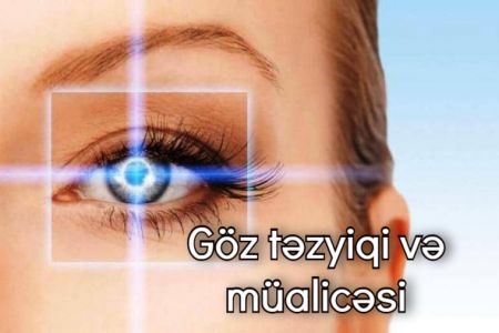 Göz təzyiqi (qlaukoma) və onun müalicəsi