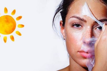 Günəş yanığına nə yaxşı təsir edir?