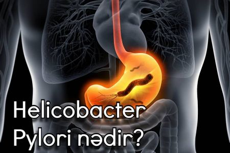 Helicobacter Pylori nədir? Simptomları hansılardır?