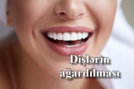 Təbii yollarla diş ağardılması üsulları