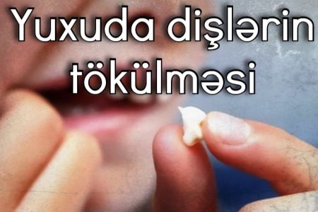 Yuxuda dişlərin tökülməsi nə anlam verir?