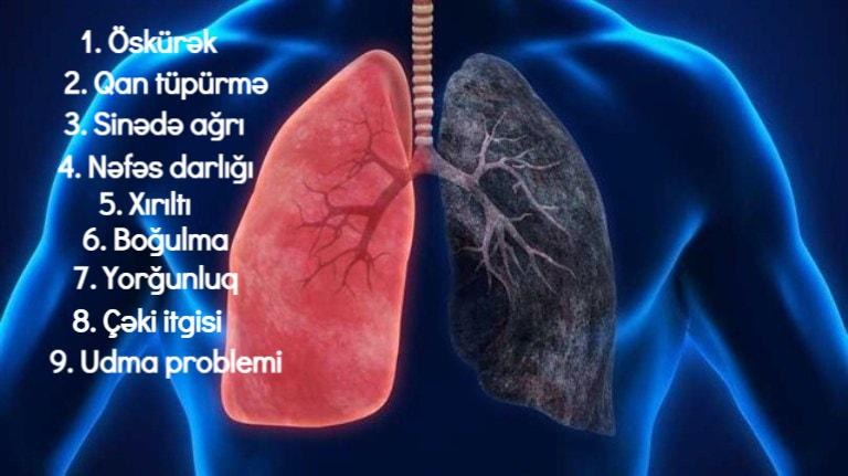 Kiçik hüceyrəli ağciyər xərçəngi nədir? Necə diaqnoz qoyulur? Müalicə necədir?