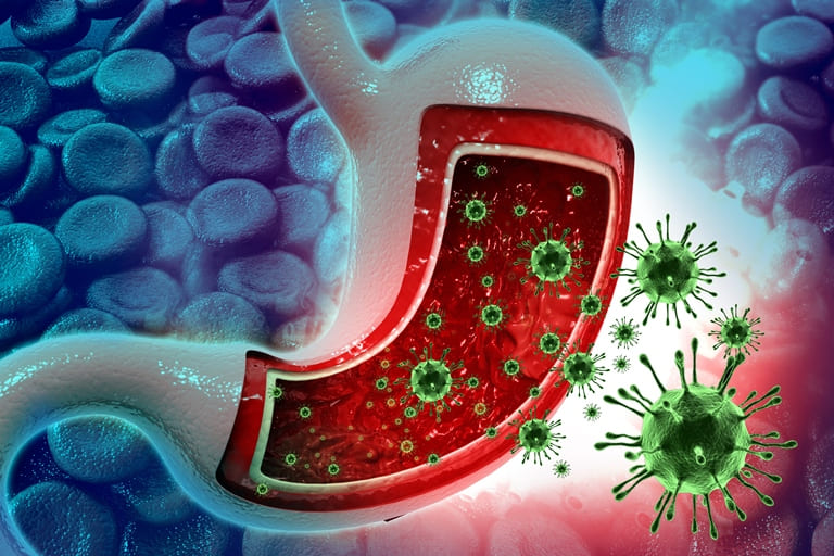 Norovirus necə müalicə olunur?